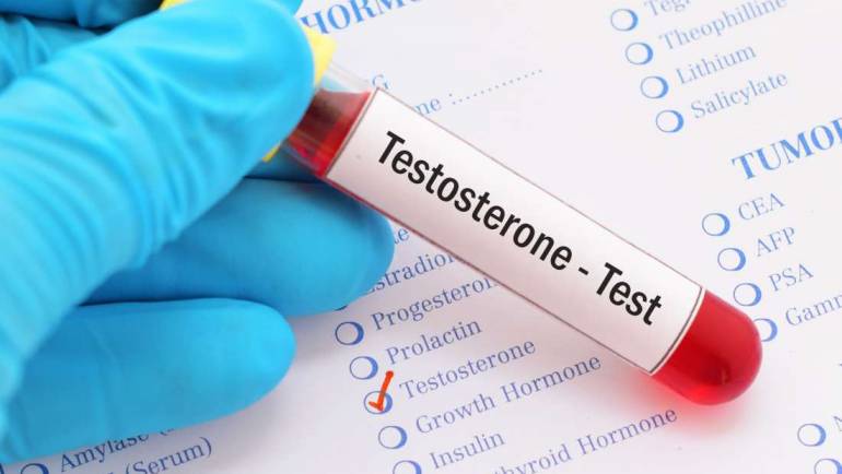 Testosterons un tā nozīme
