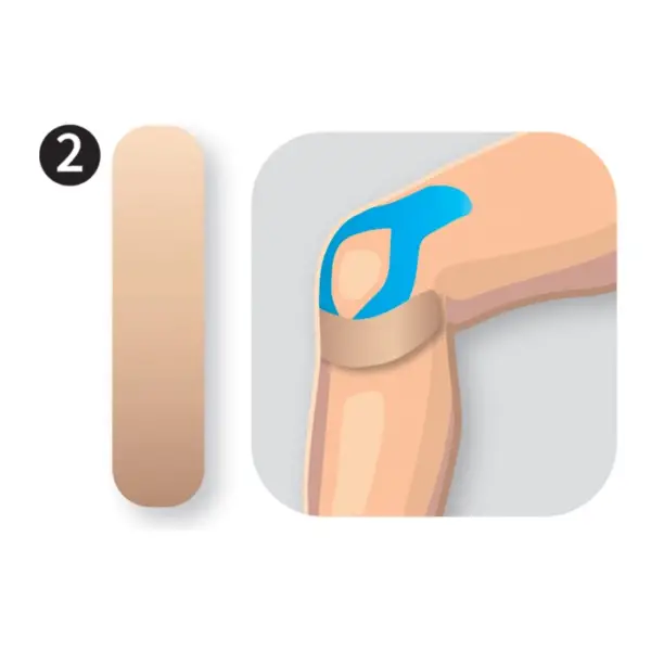 Teips celim / PreCut Knee - Image 3