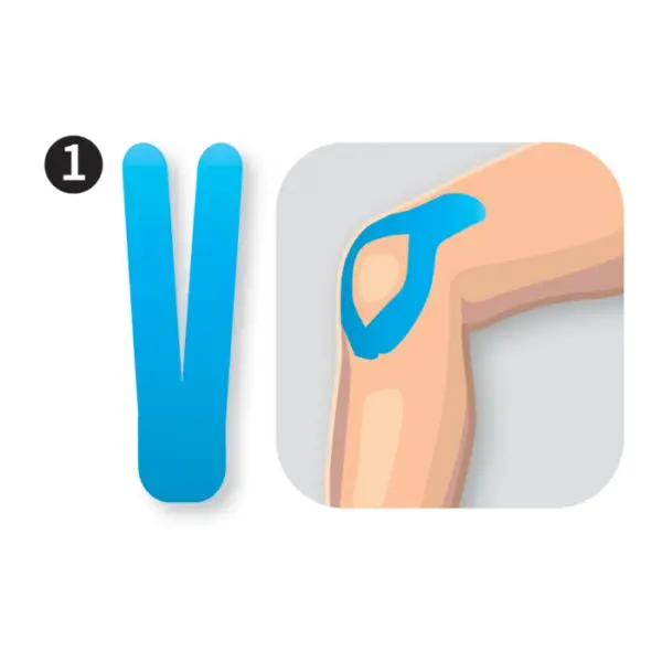 Teips celim / PreCut Knee - Image 2